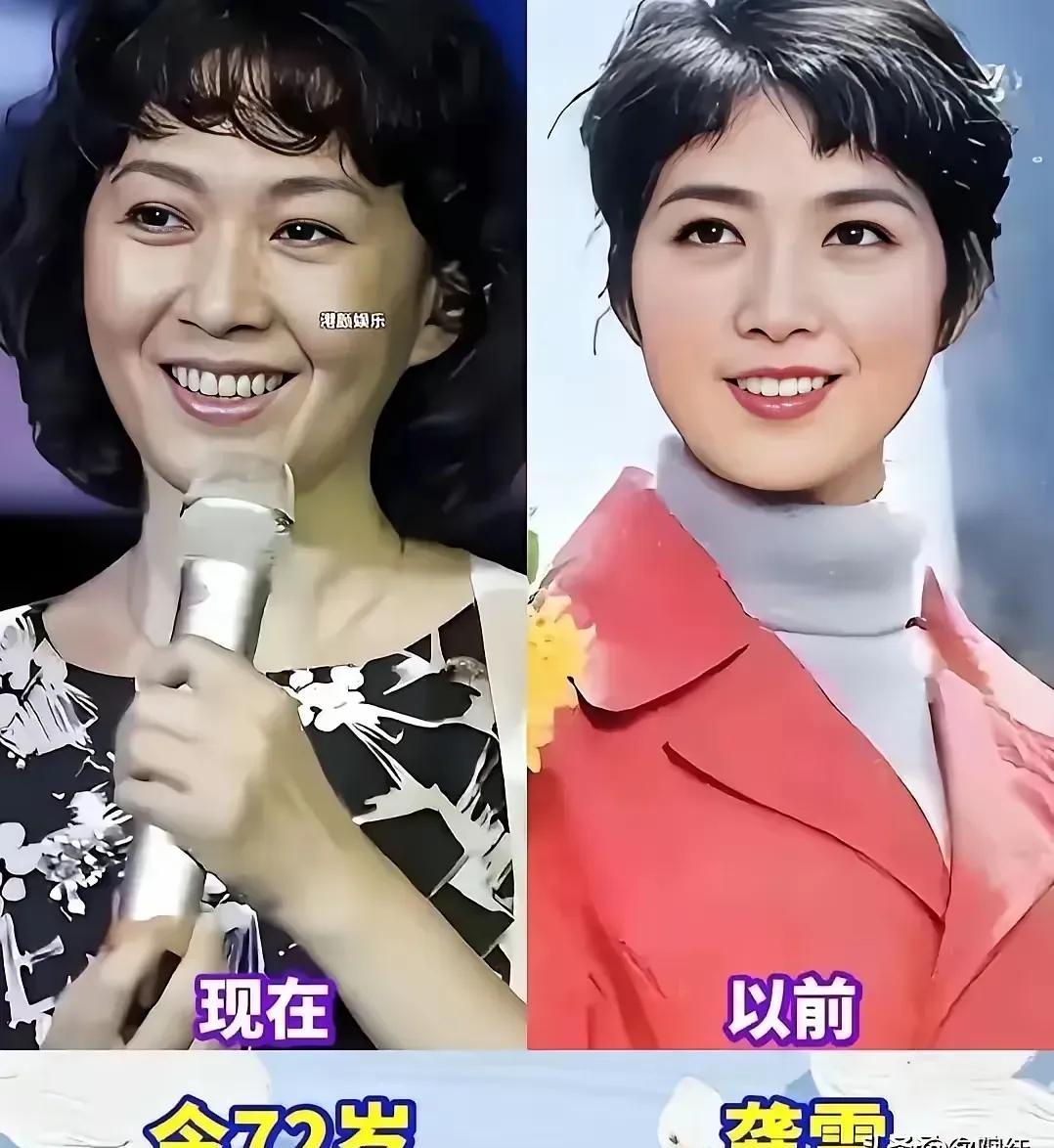 看到朱琳和巩俐的近照，我脑子里就蹦出四个字：降维打击。
一个71岁，一个58岁。