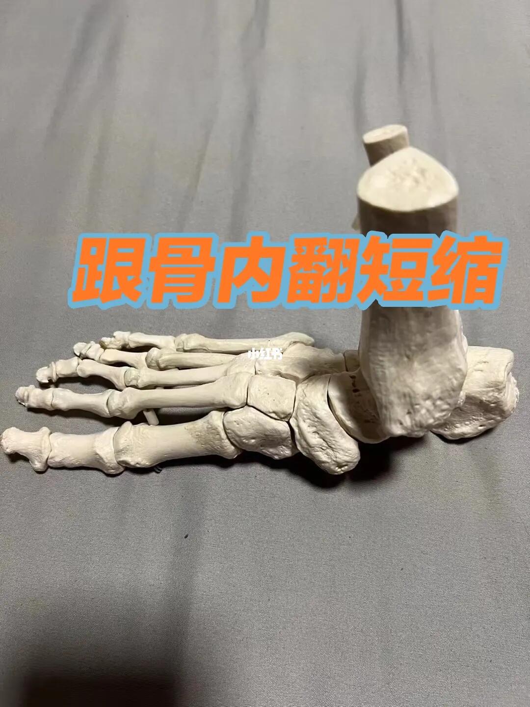 跟骨内翻