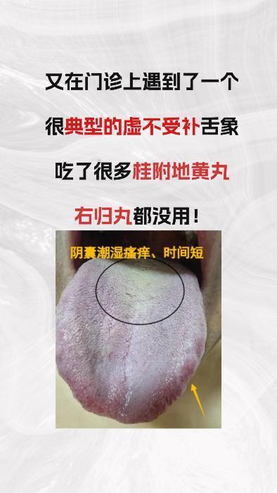 又遇到一位虚不受补的患者，吃了很多桂附地黄丸都没有用