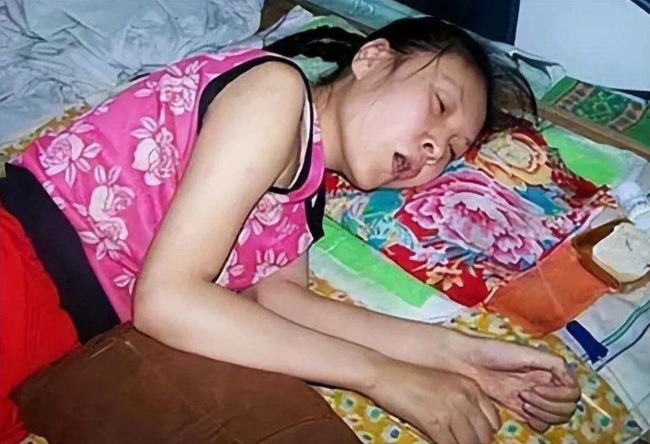 河北15岁女孩，被哥哥打了2巴掌后突然瘫痪，卧床近20年，父母离开后，嫂子开始照