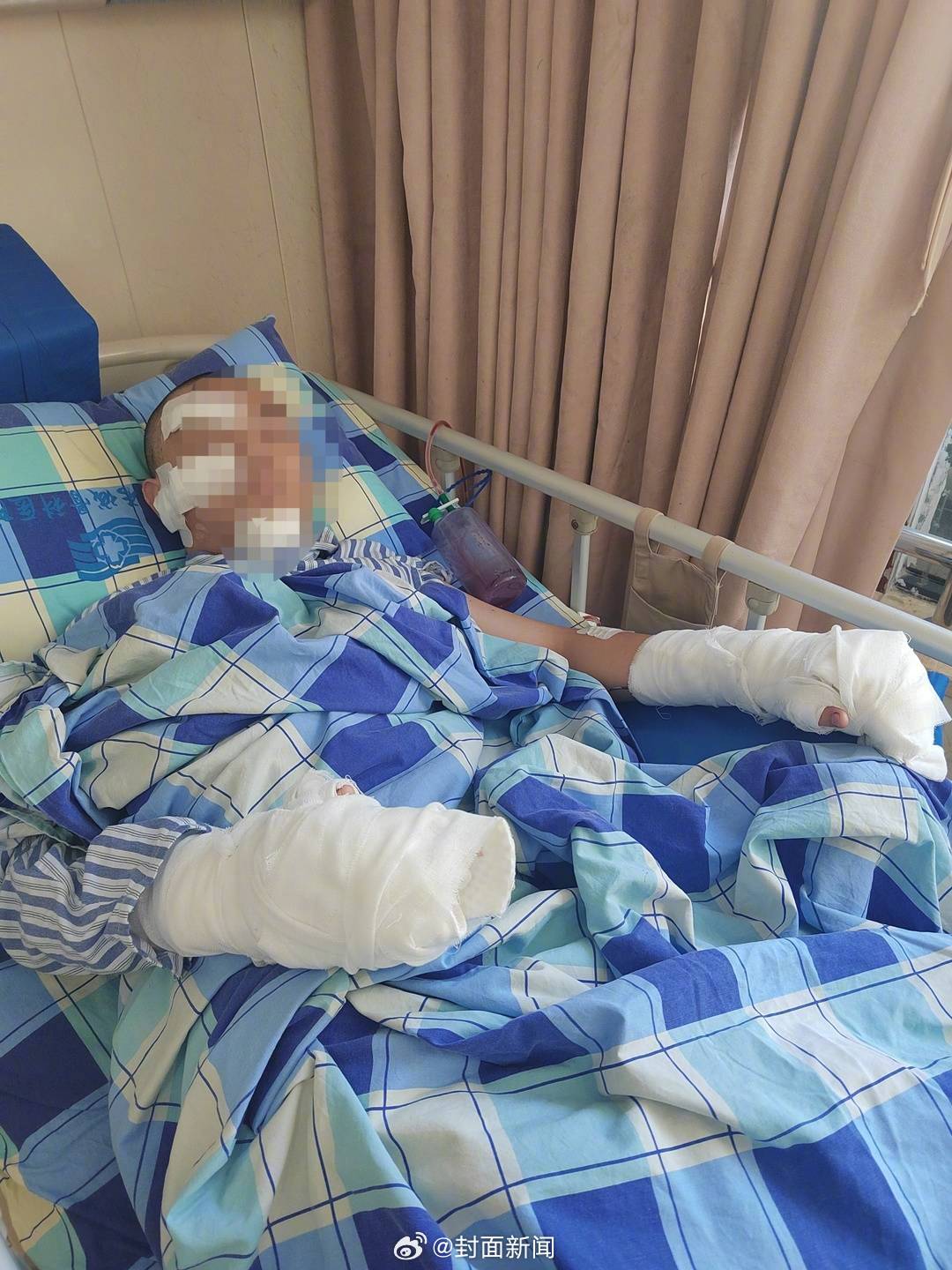 【#准大学生旅游被陌生男子持刀砍伤# 学生母亲：望嫌疑人家属露面协商】8月7日，