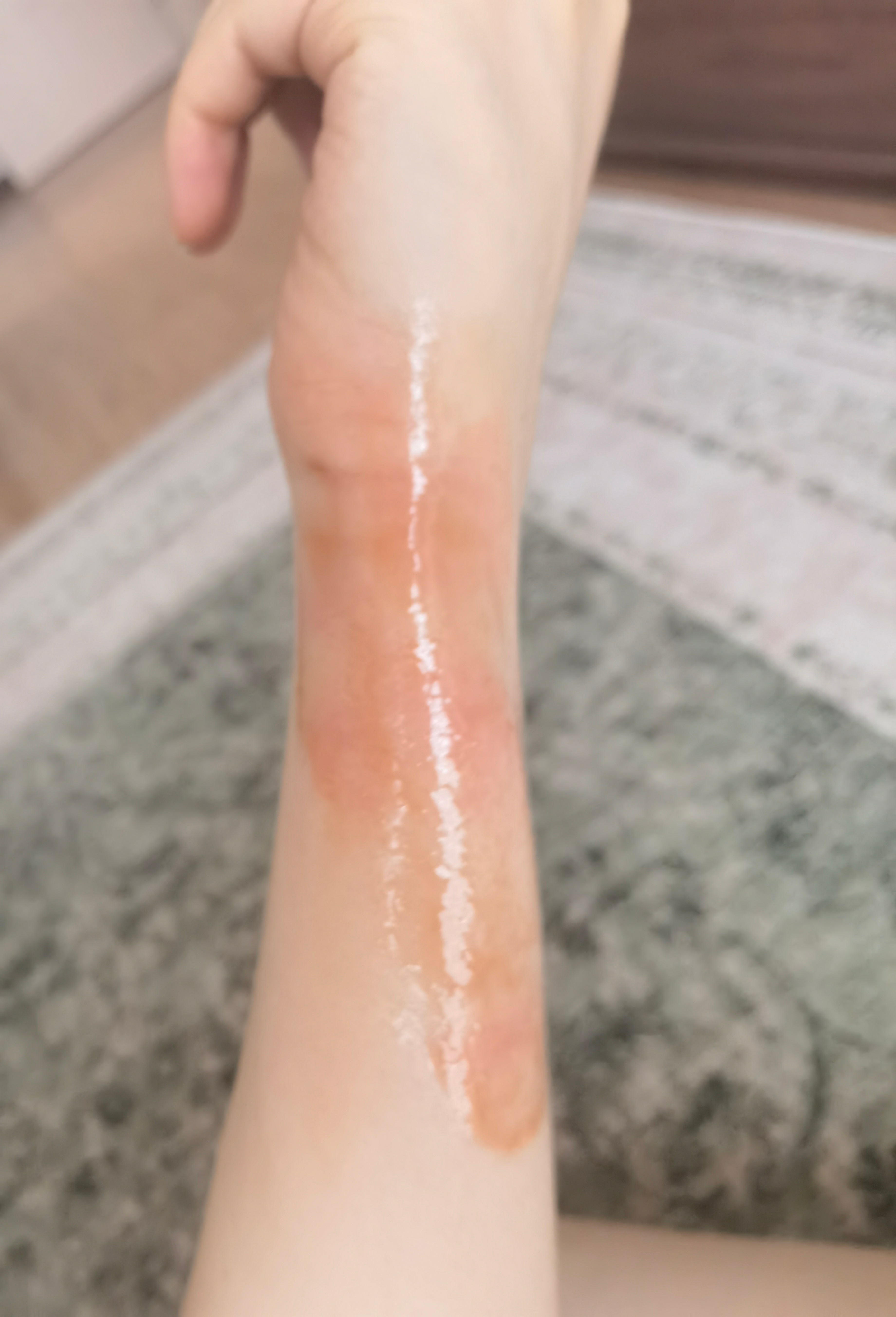 倒霉的一天……被烫不说还被雨淋得瓜兮兮的去买烫伤膏回来抹 