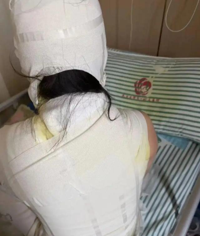 “万万没想到！”9月7日报道，江西一女子本来想花钱放松一下，结果把自己送进了烧伤