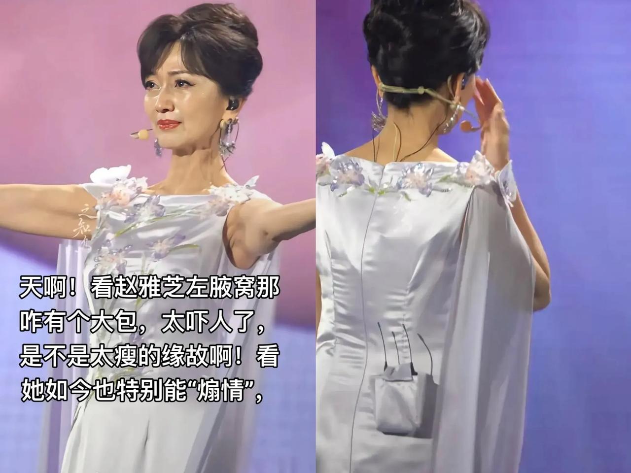天啊！看赵雅芝左腋窝那咋有个大包，太吓人了，难道是太瘦闹的？而且她现在咋老爱“煽