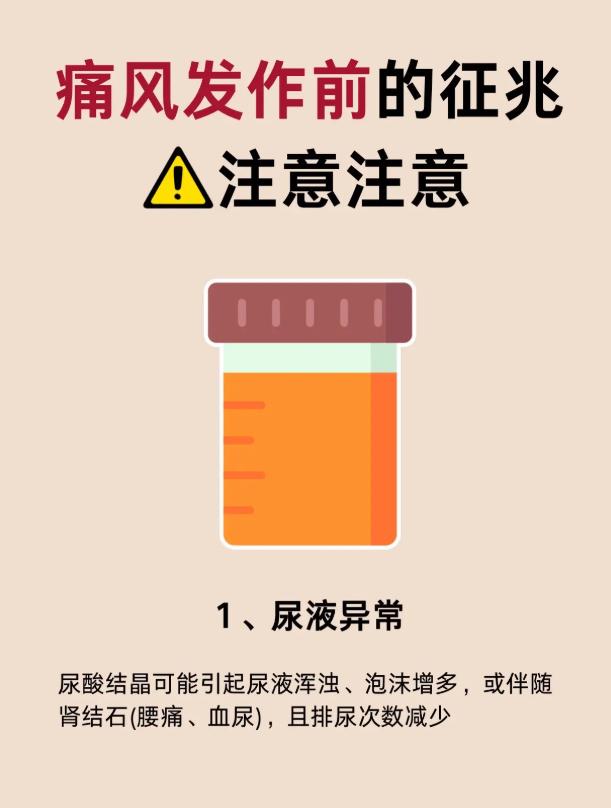 痛风发作并非突然，前期征兆一定要留意