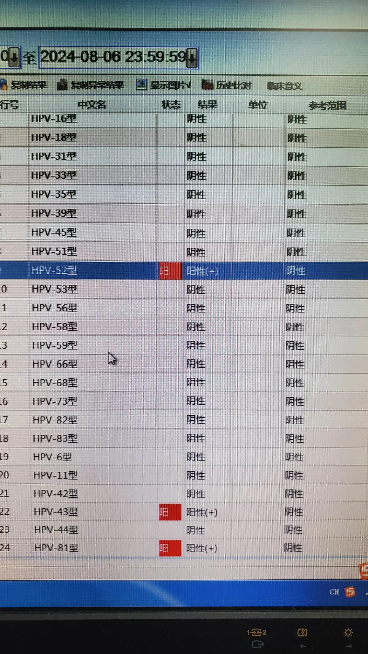 hpv感染  宫颈癌