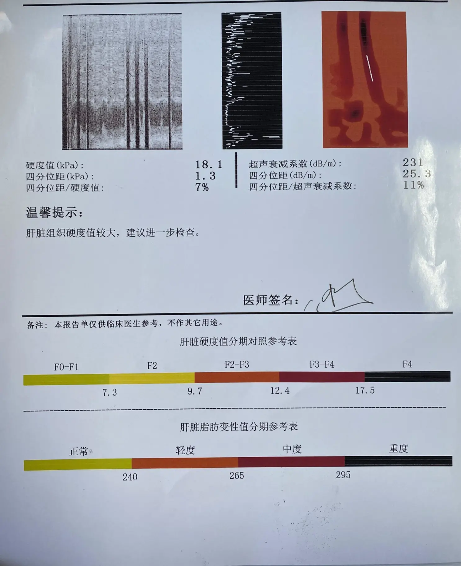 肝脏弹性报告怎么看？！。肝弹报告中主要看其中两个指标，一个是肝脏的硬度...