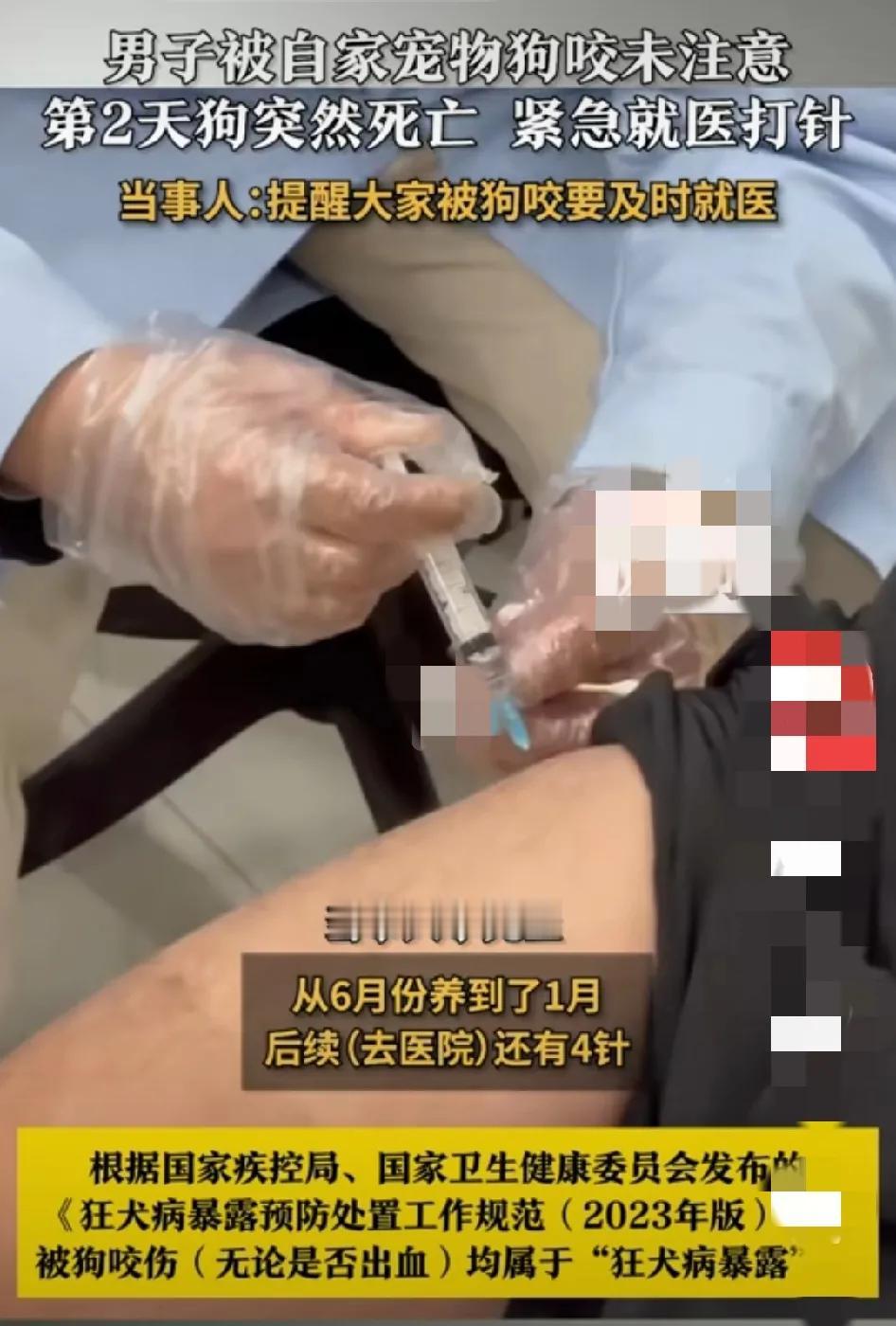 这是狗有毒？还是人有毒啊？怎么人挨咬狗🐶死了呢？被这个事件发生的整蒙了，到底是