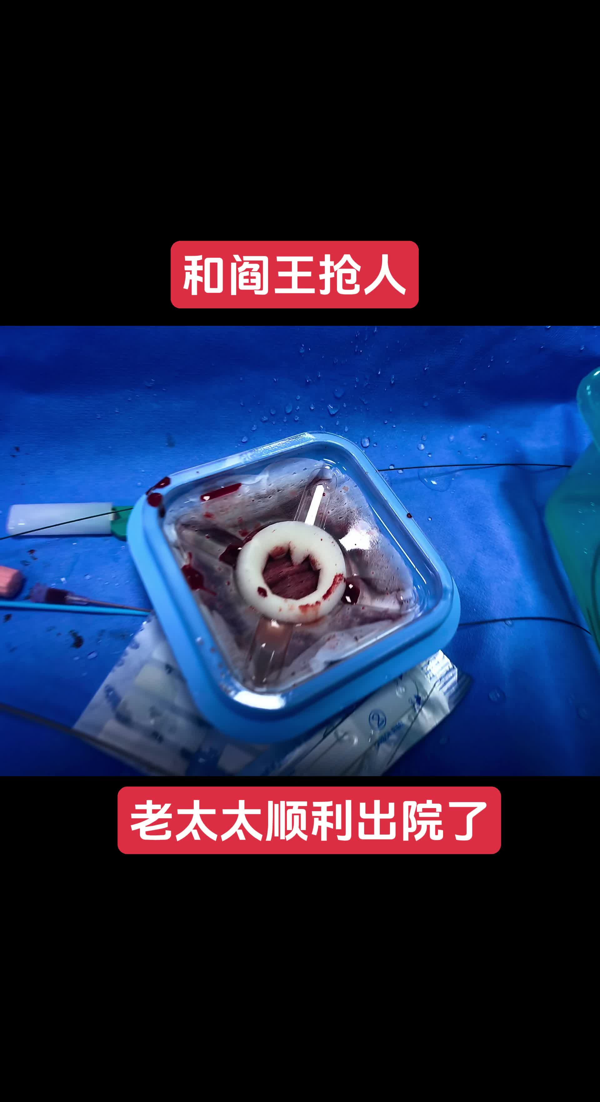 老太太很坚强，我们医生也很努力 老太太急性心肌梗死多日入院，呼吸急促...