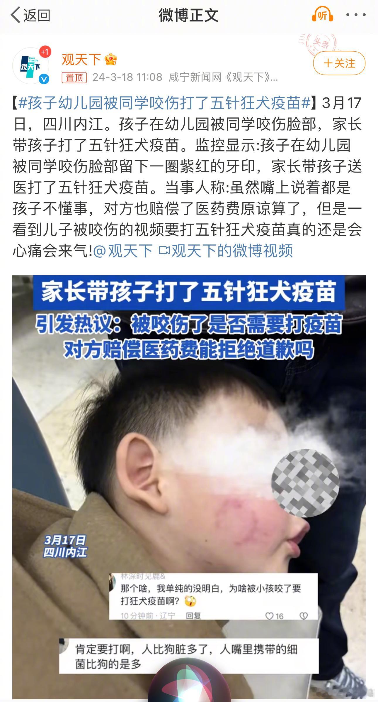#孩子幼儿园被同学咬伤打了五针狂犬疫苗#这么表浅的伤口，根本不需要打破伤风抗毒素