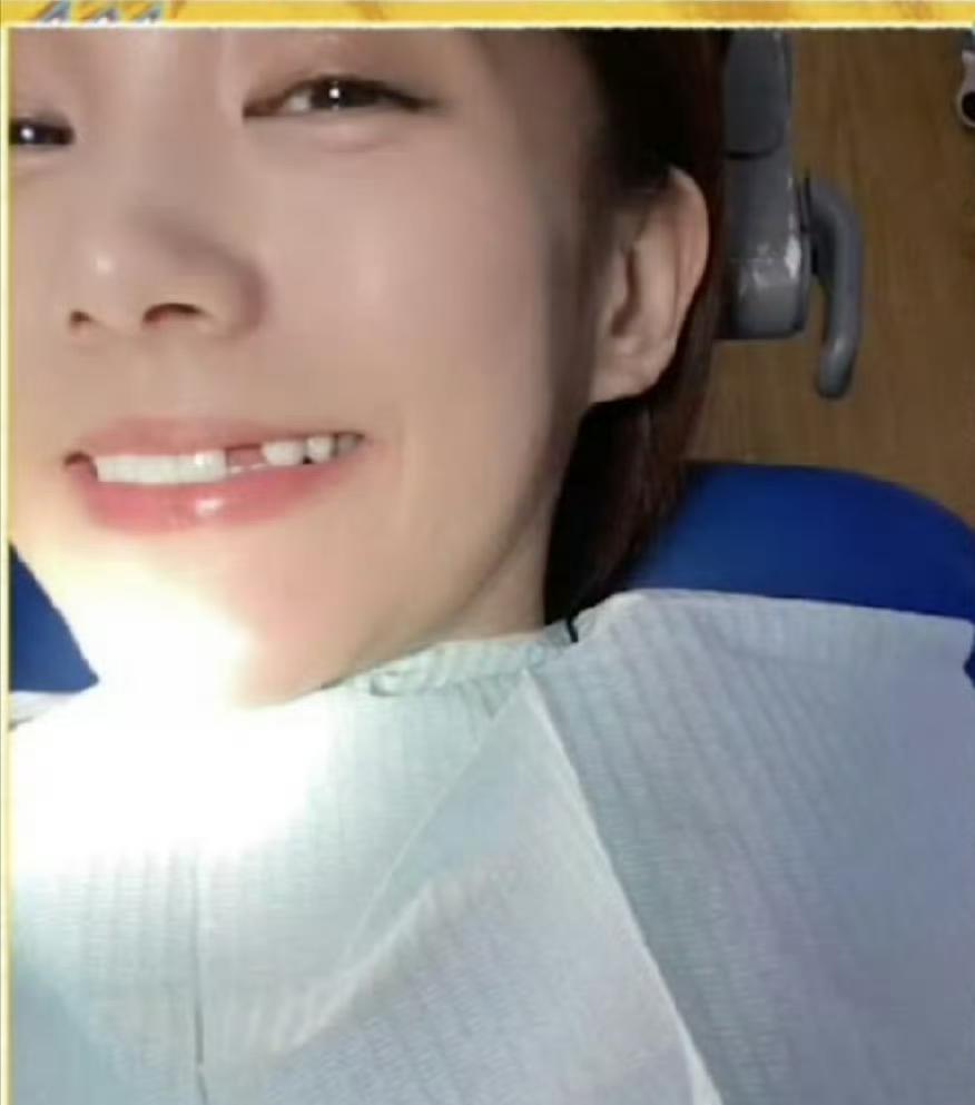 李一桐在拍戏时把牙都给磕掉了，牙根碎裂，只能安装假牙，但假牙一点也不方便，吃东西