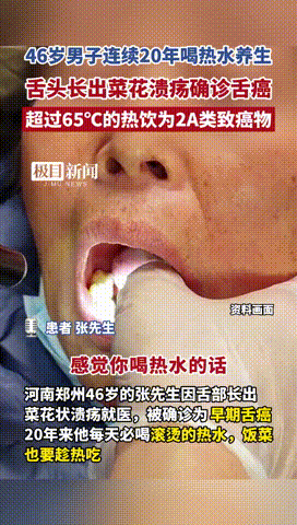 “真是个神人！”河南郑州，46岁男子看到嘴里有菜花状的溃疡后，就赶紧到医院检查，