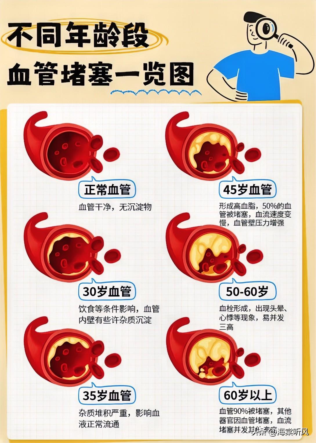 为什么越来越多的人出现血管堵塞?
1. 吃得太“好”了
现在生活条件上去了，顿顿