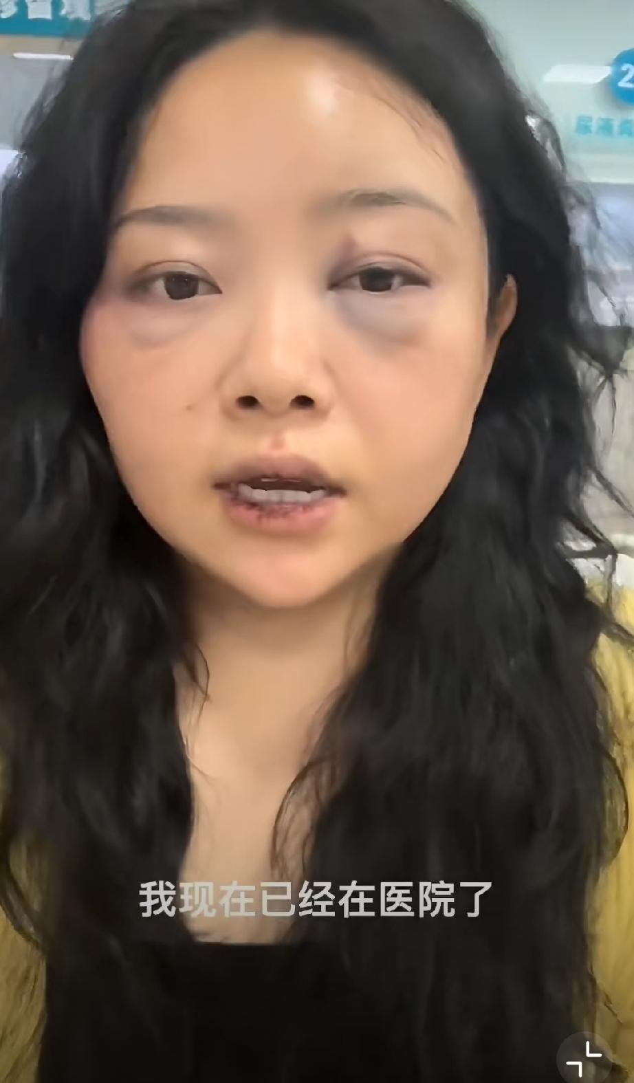 跑到菲律宾，与网上认识半年与菲律宾网友奔现追求真爱，结果见面不久后就开始挨揍
呵