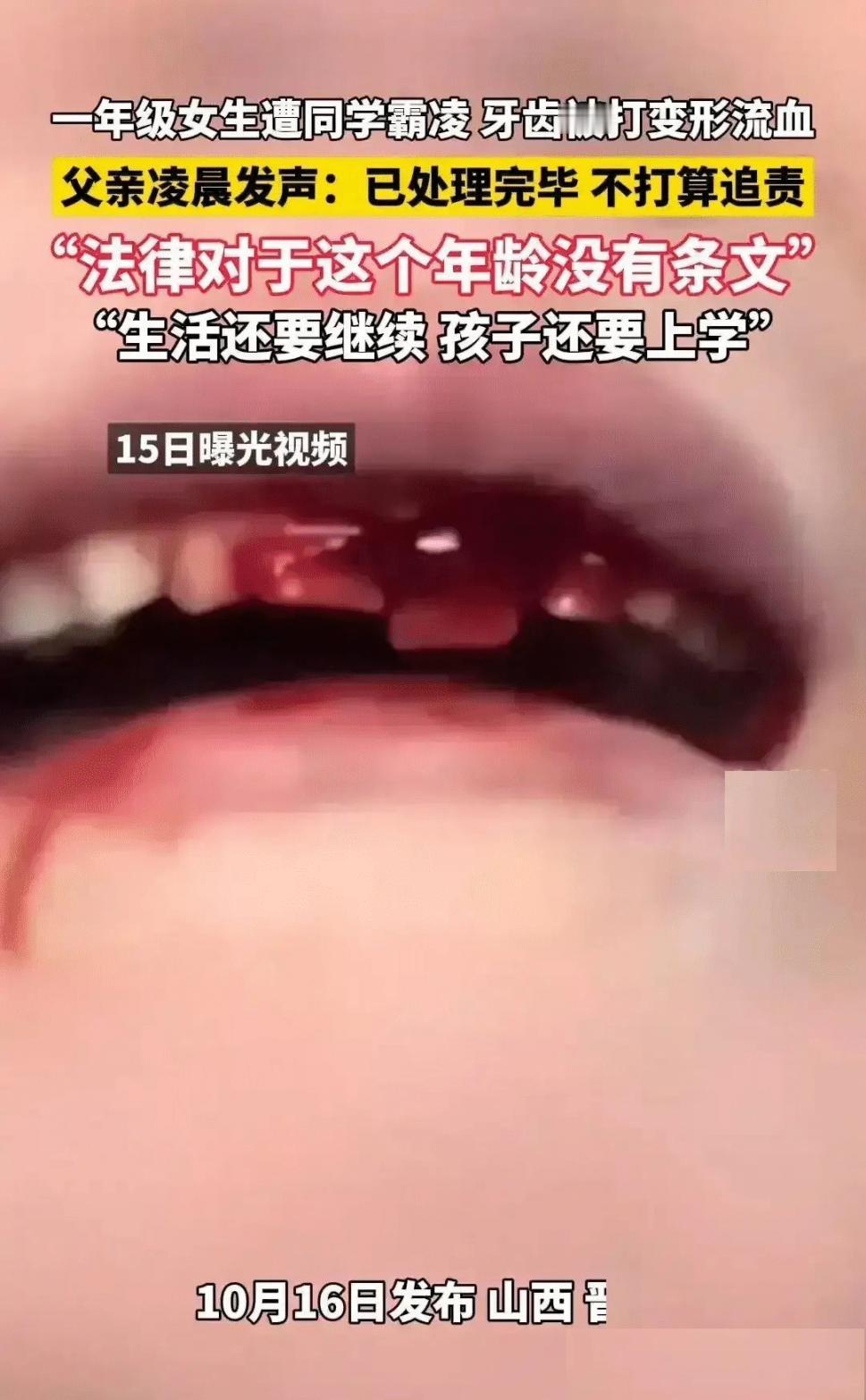 “我一分钱没要，他们也没说要赔。”一年级女生被8名同学打得满嘴是血，女生爸爸竟然