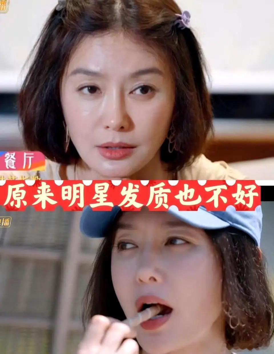 秦岚有上镜需求，每天都会弄头发，发质差也是很正常的。 ​​​
