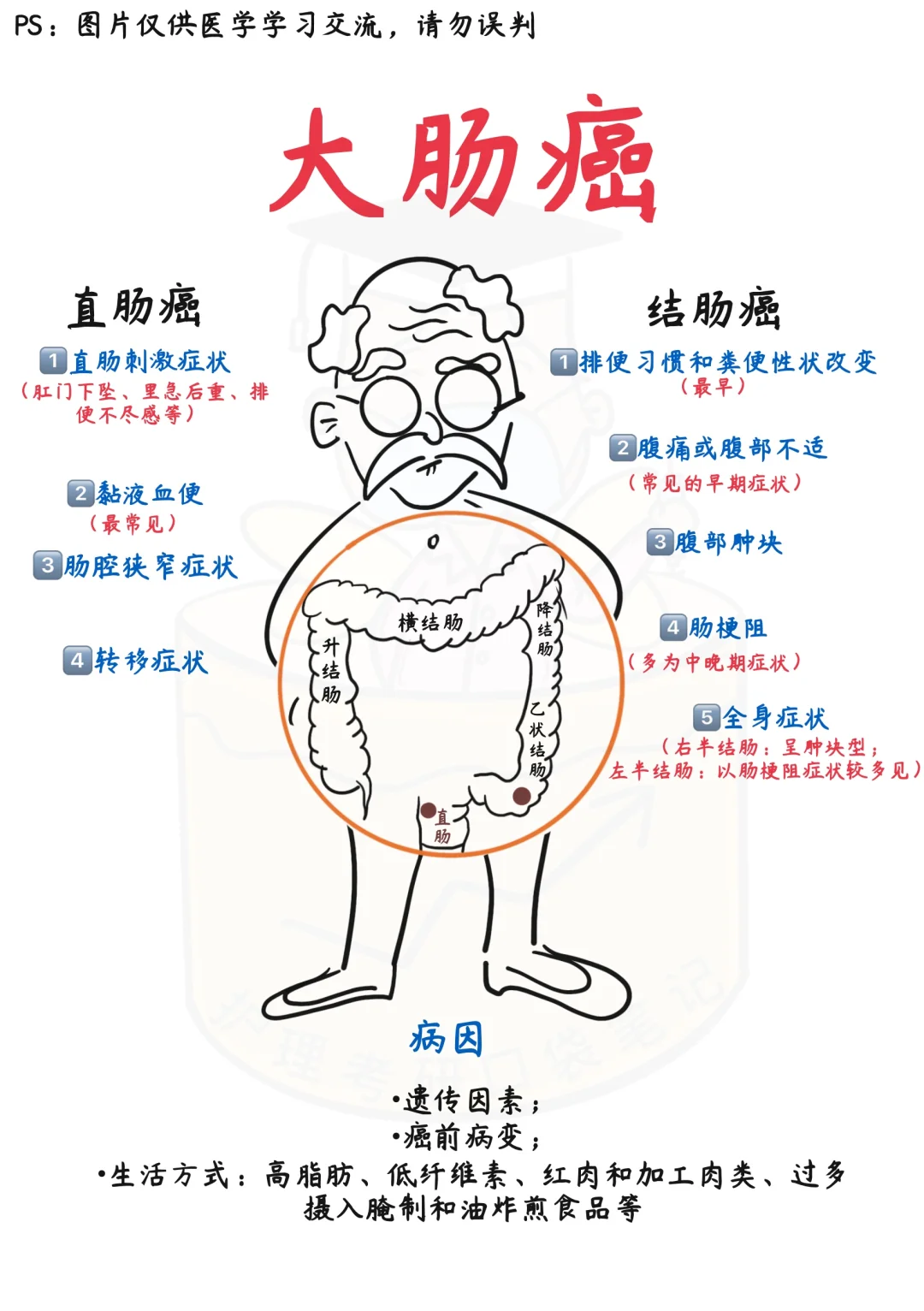 📒医学生笔记｜一图搞懂大肠癌✅干货收藏