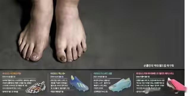 韩国《中央日报》晒出一张孙兴慜裸足实拍照片，孙兴慜的脚部严重扭曲：多处脚趾甲脱落