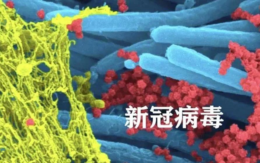新冠确诊的人越来越多？医生再次强调：宁可吹空调，也别做这7事

最近地铁里咳嗽声