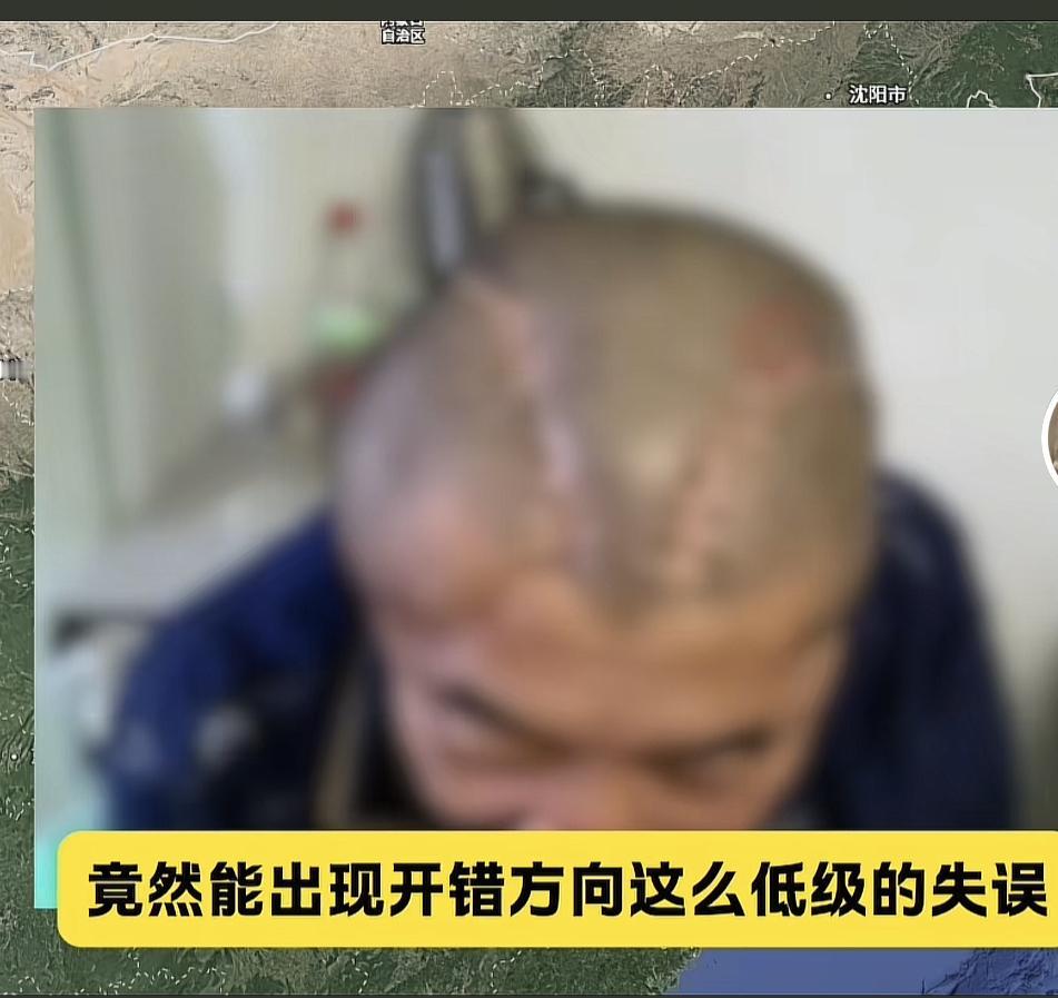 右脑出血，却被医生打开左脑，发现开错后又将左脑缝合，再次打开右脑，这样的剧情连编