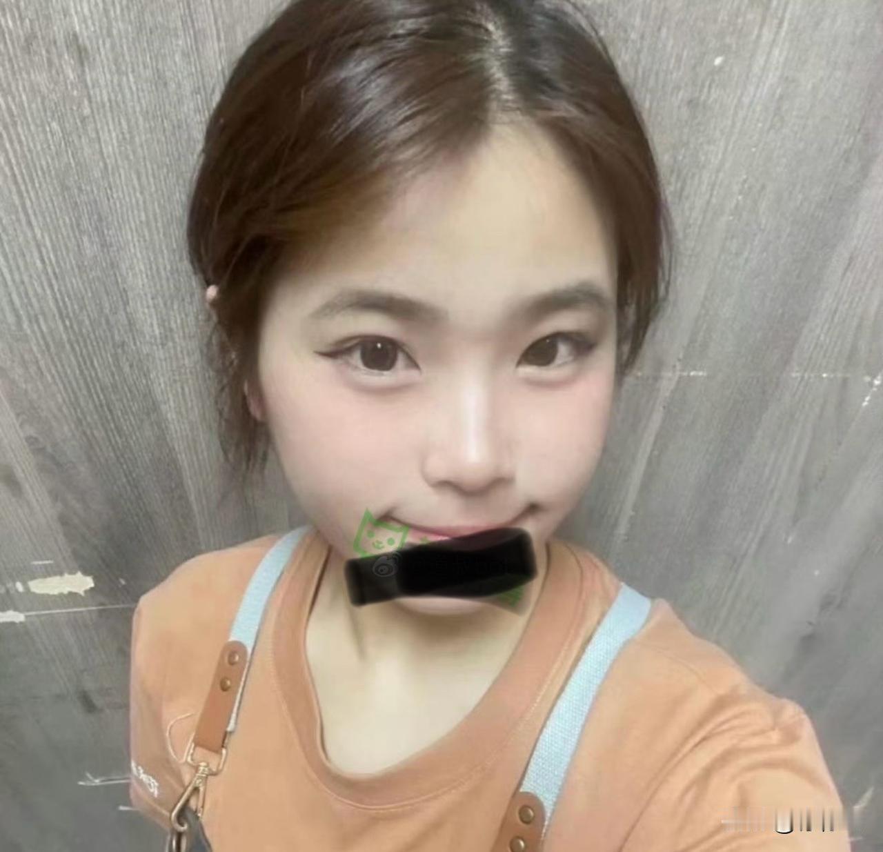 49万手术费‼️在四川党岭徒步，因严重高原反应休克失温的姑娘，情况很不乐观！
如