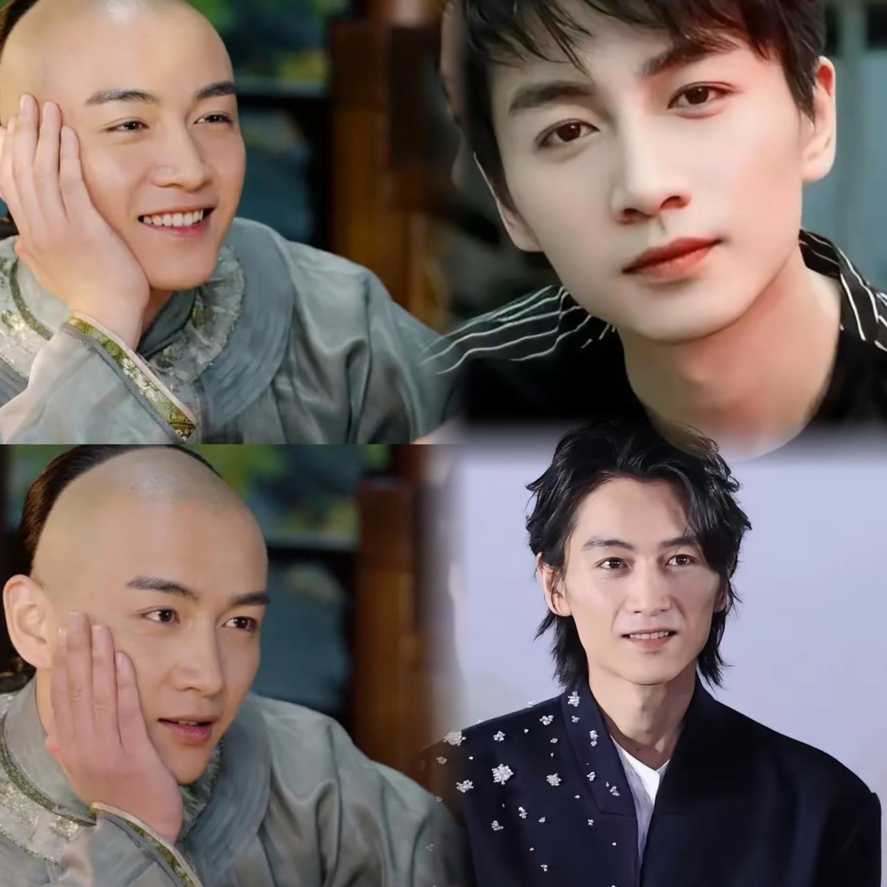 为什么我感觉陈晓的面相变了呢，
他年纪也不大才38岁，
法令纹、眼角纹都冒出来了