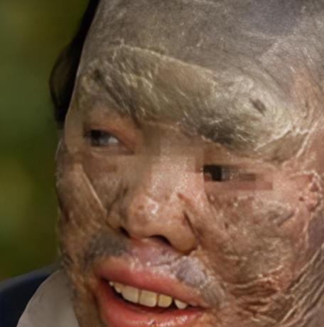 吃蛇太多变蛇人？2003年辽宁省，村民韩永波有个特殊的爱好——爱吃蛇，不仅顿顿有