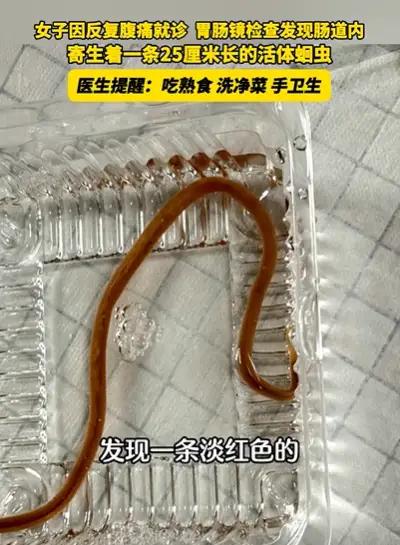 浙江金华，40多岁的王女士原本以为只是普通的腹痛，没想到竟隐藏着一个惊天秘密。几