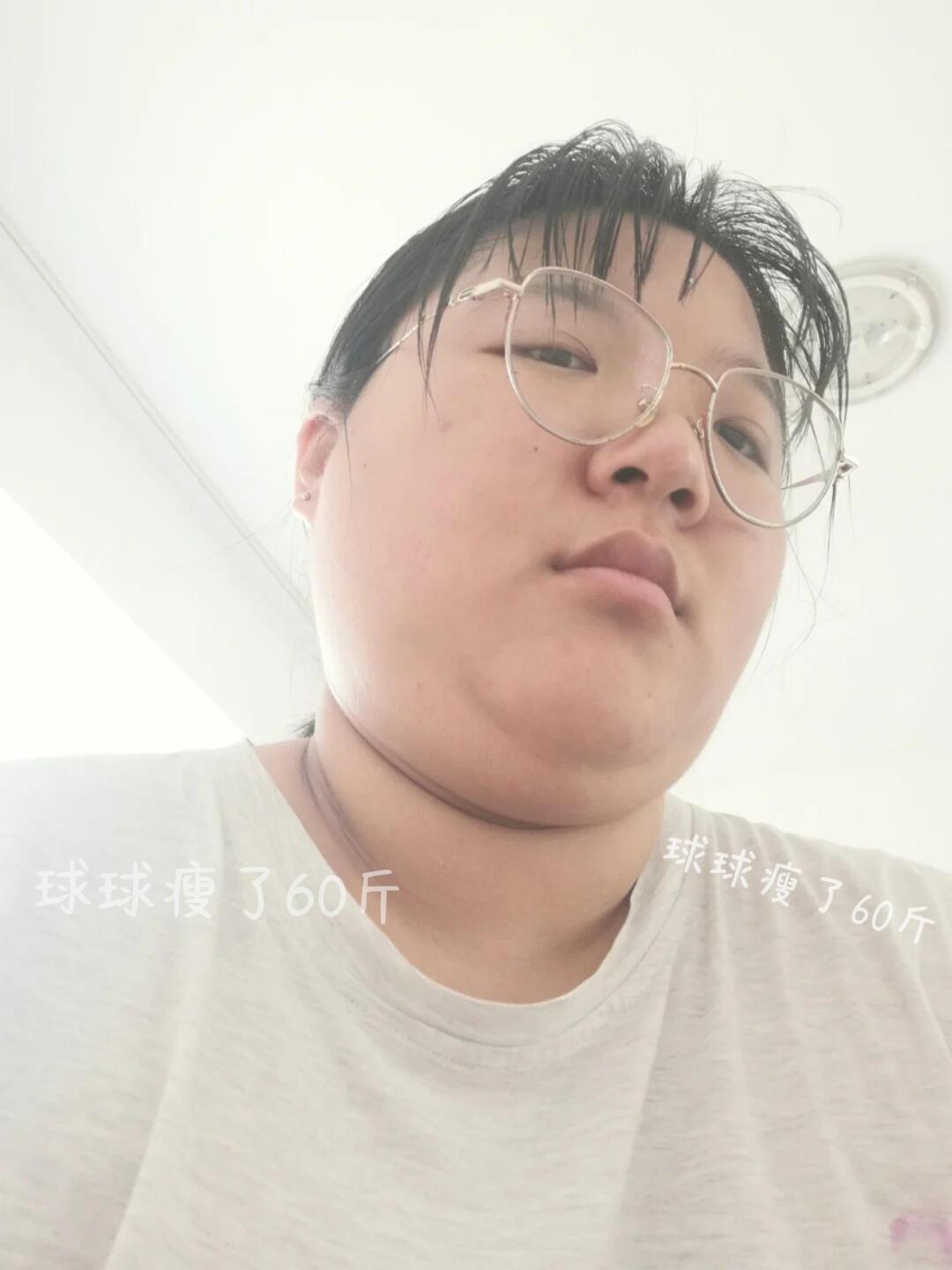 多囊，戒糖+减脂1年身材已达nextlevel