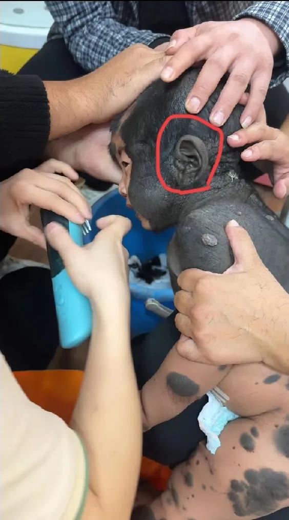 乐宝是一个非常可怜的孩子，身上有兽皮痣，皮肤特别的脆弱，无法像正常人一样，皮肤能