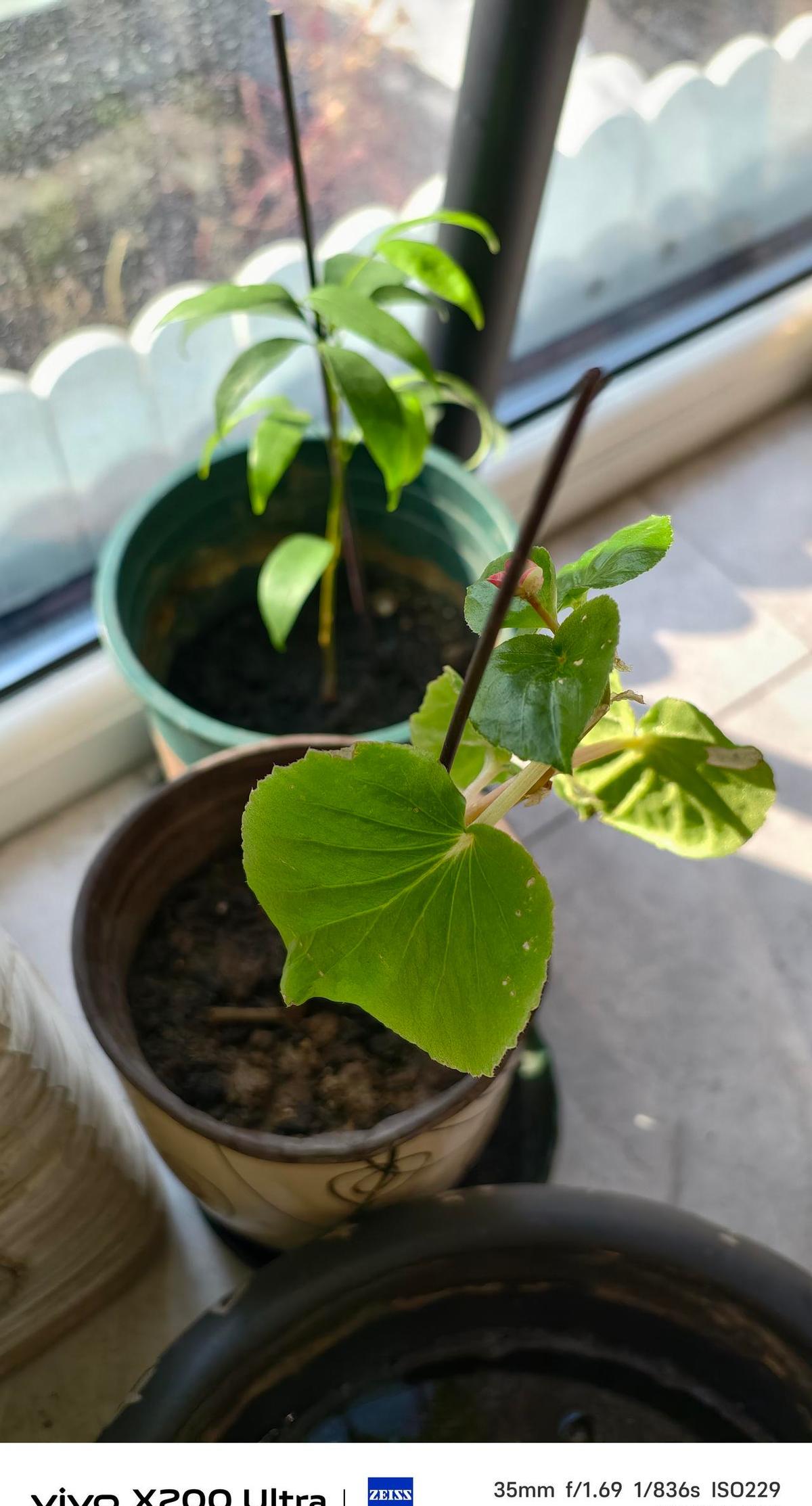 我妈90岁，每天把同一捆青菜洗三遍，水费单看得我肉疼。
直到医生告诉我，重复动作