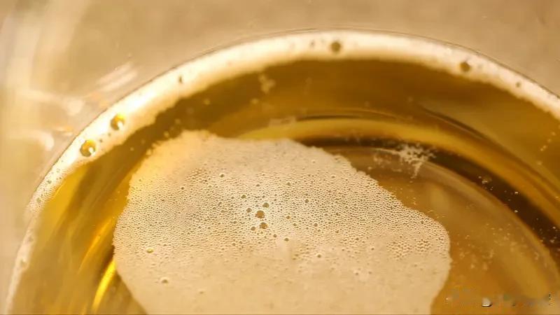 尿出泡沫不一定是肾有病。尿液有泡沫分生理性和病理性。
生理性的，像排尿过急、尿液