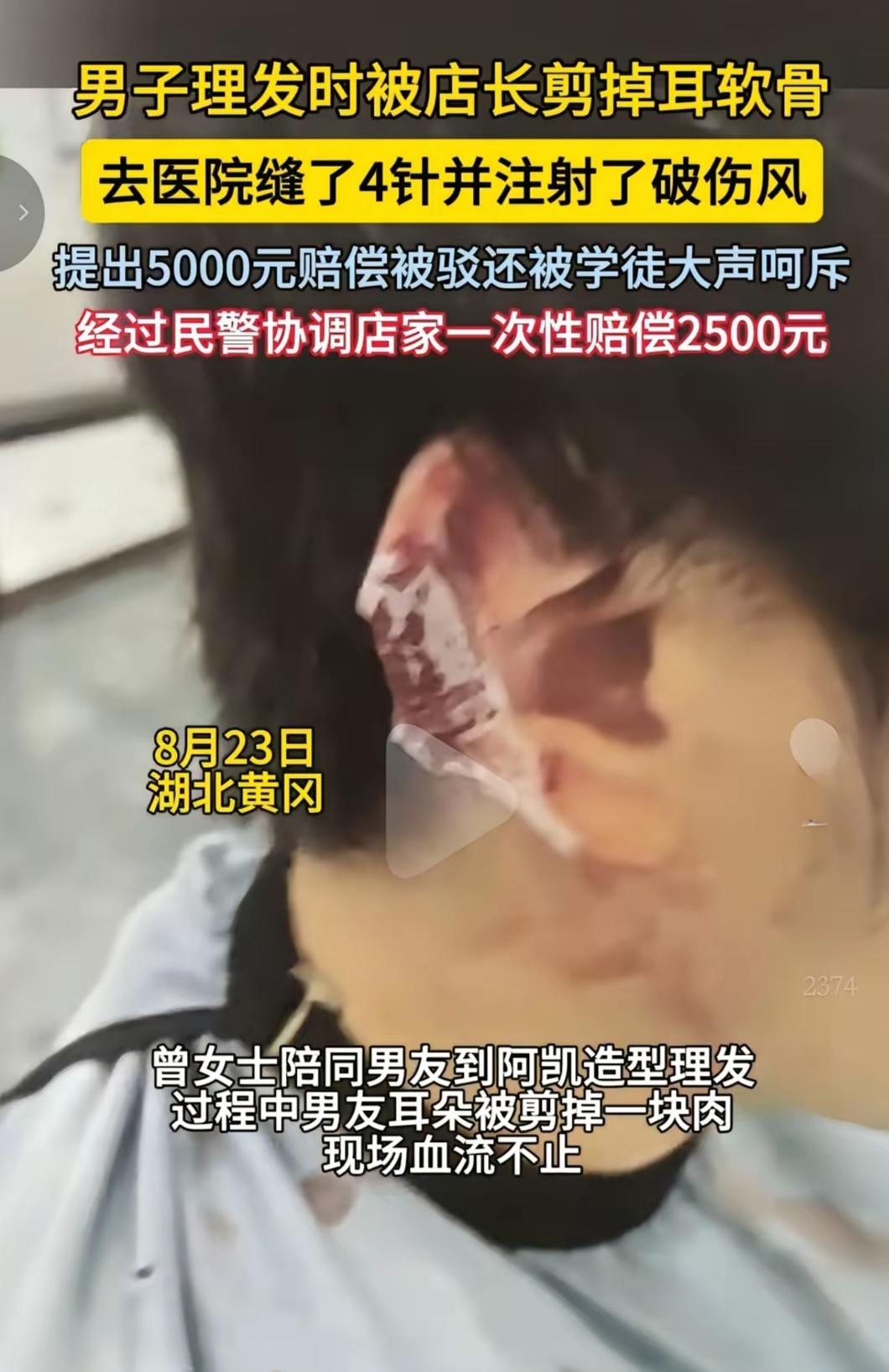 今天刷到一则新闻，讲的是湖北黄冈有一男子去理发店理发，结果被店长不慎剪掉耳软骨，