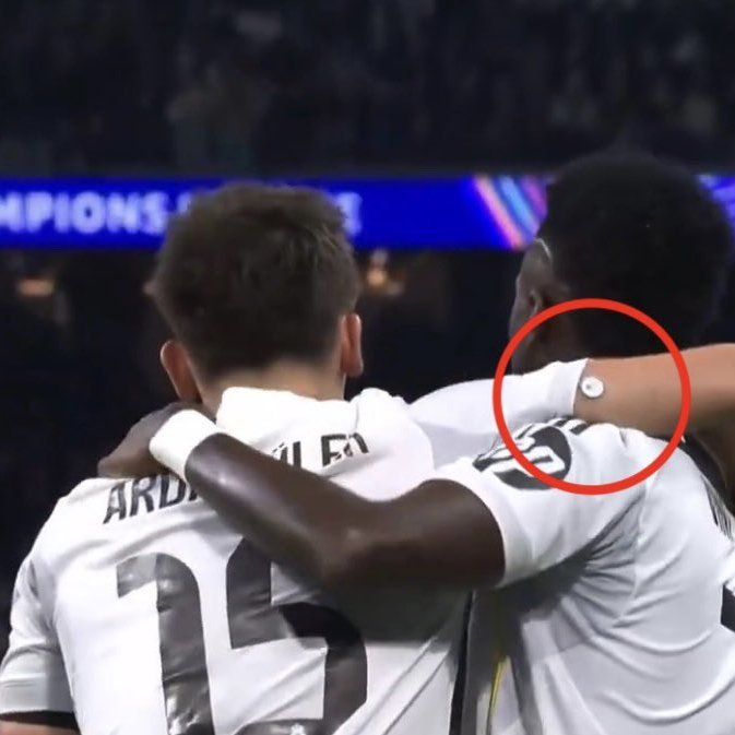 昨晚皇家马德里战胜摩纳哥的比赛中，球迷们发现阿尔达·居勒手臂上戴着血糖监测仪。 