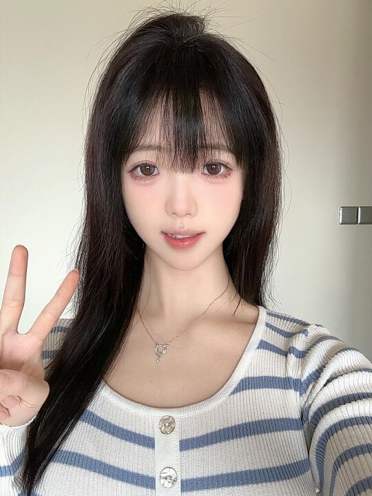 太阳穴凹陷微调这次没翻车