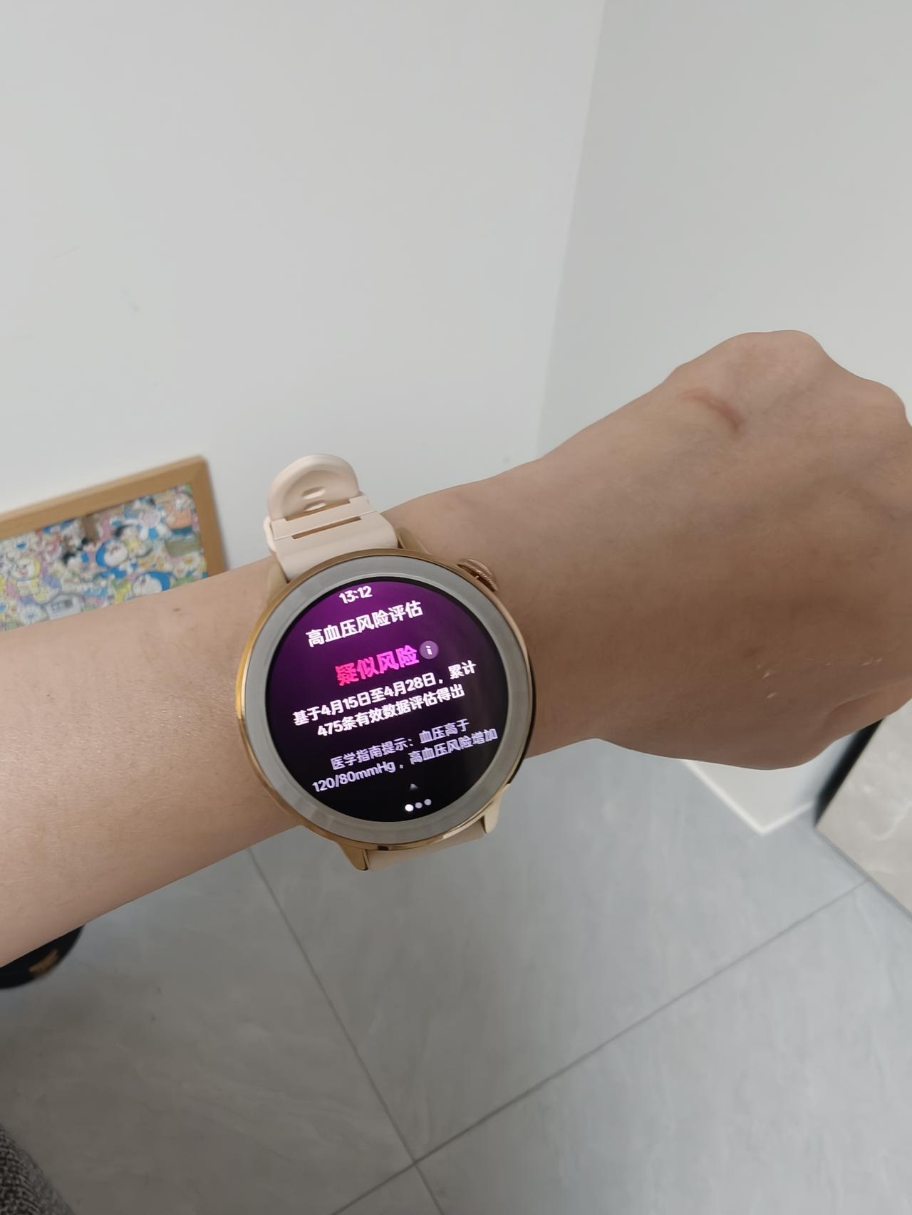 真没想到OPPO手表还有这个功能？
首发入的OPPO Watch X3 mini