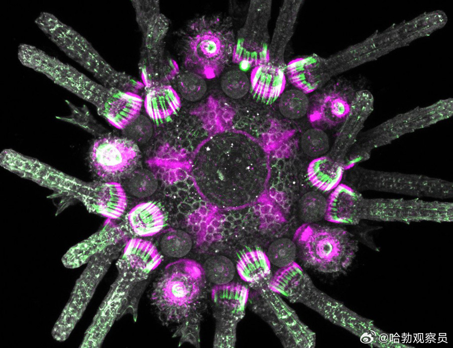 最新研究发现：海胆全身遍布“脑袋”！11月5日，发表在Science Advan