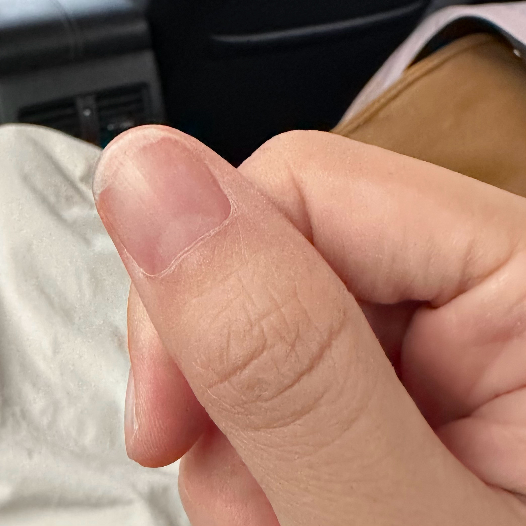 早起出来体检了！最近见了几个朋友，大家现在身体多少都有点毛病了[允悲]我有个女生