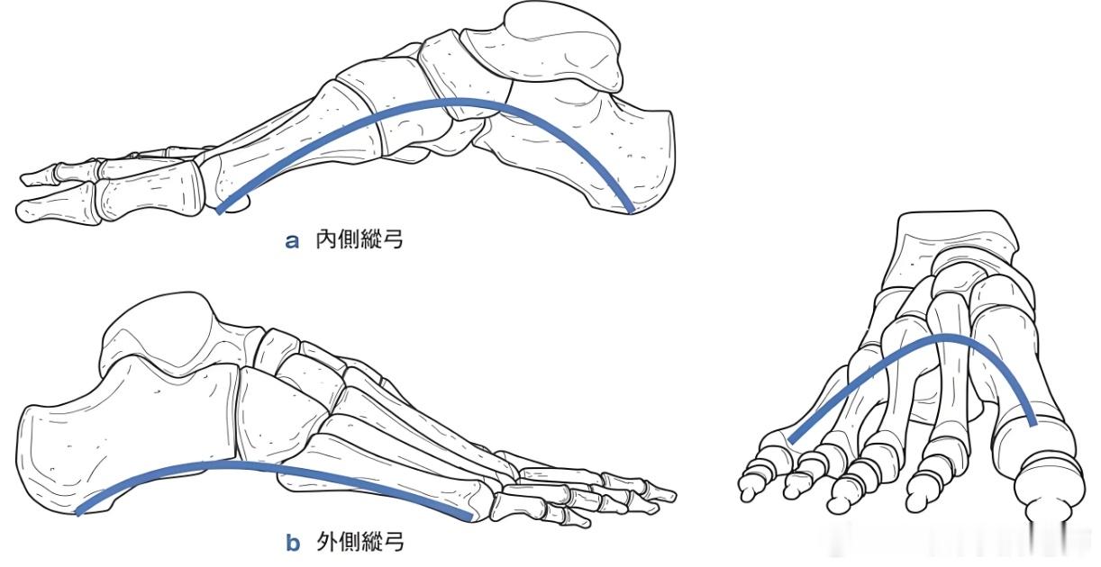 足弓塌陷 给大家看一张足弓解剖图我们日常说的足弓塌陷，一般是指内侧纵弓塌陷，不过