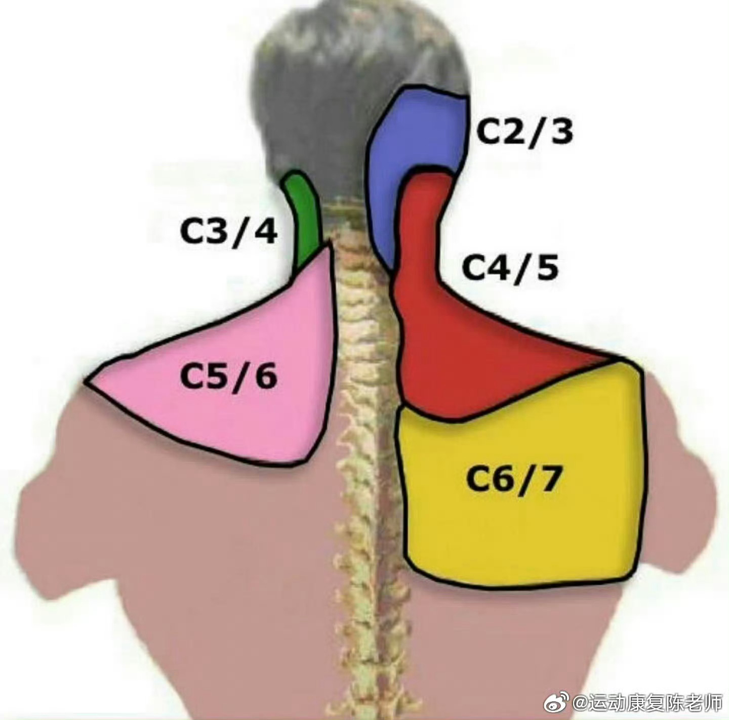 肩颈酸痛  前段时间去做活动，发现好多办公室久坐的朋友们都有点肩颈不适。那就再发