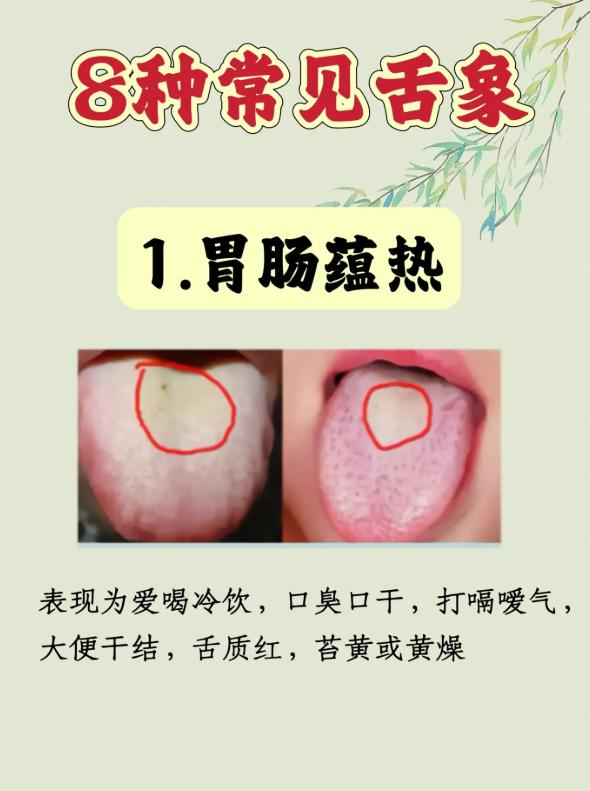 8 种常见舌象，一眼看懂身体状况