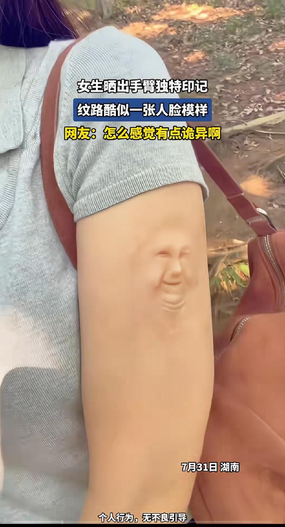 手臂上长着一张丑陋的人脸，看着就有点吓人！

大千世界，无奇不怪。刚刚刷到一个视