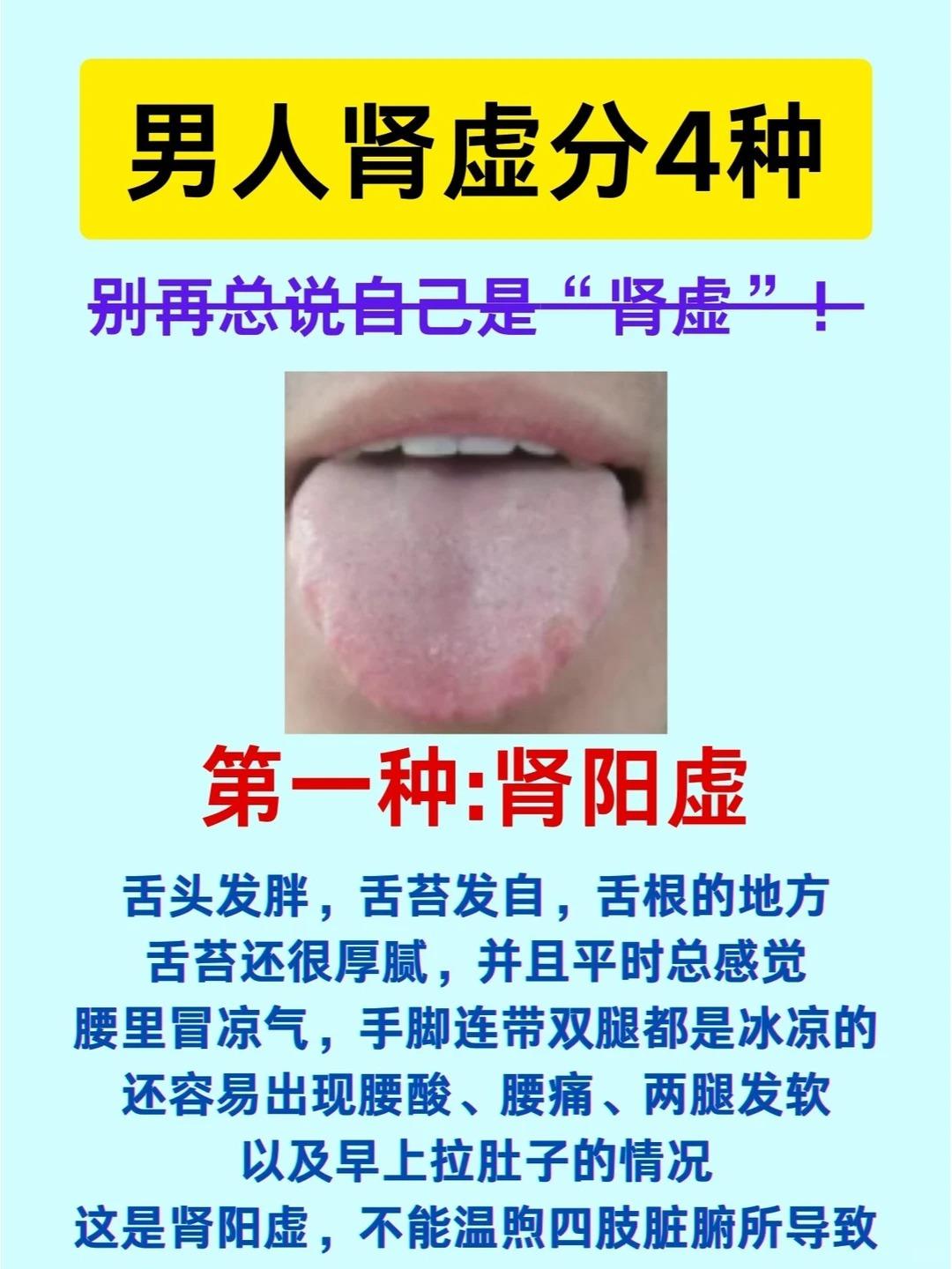 男人肾虚分4种 别再总说自己是“肾虚”~