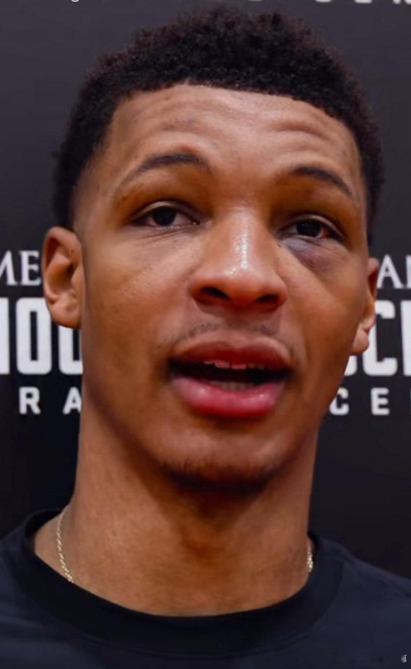 贾巴里史密斯上一场是被国王围殴了吗？都两天了还没见好！！休斯敦火箭vogue预告