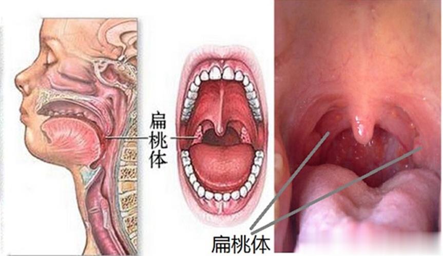 #咽喉炎# 原国家卫生部的一项调查显示,70%的白领人群患有不同程度的“办公室病