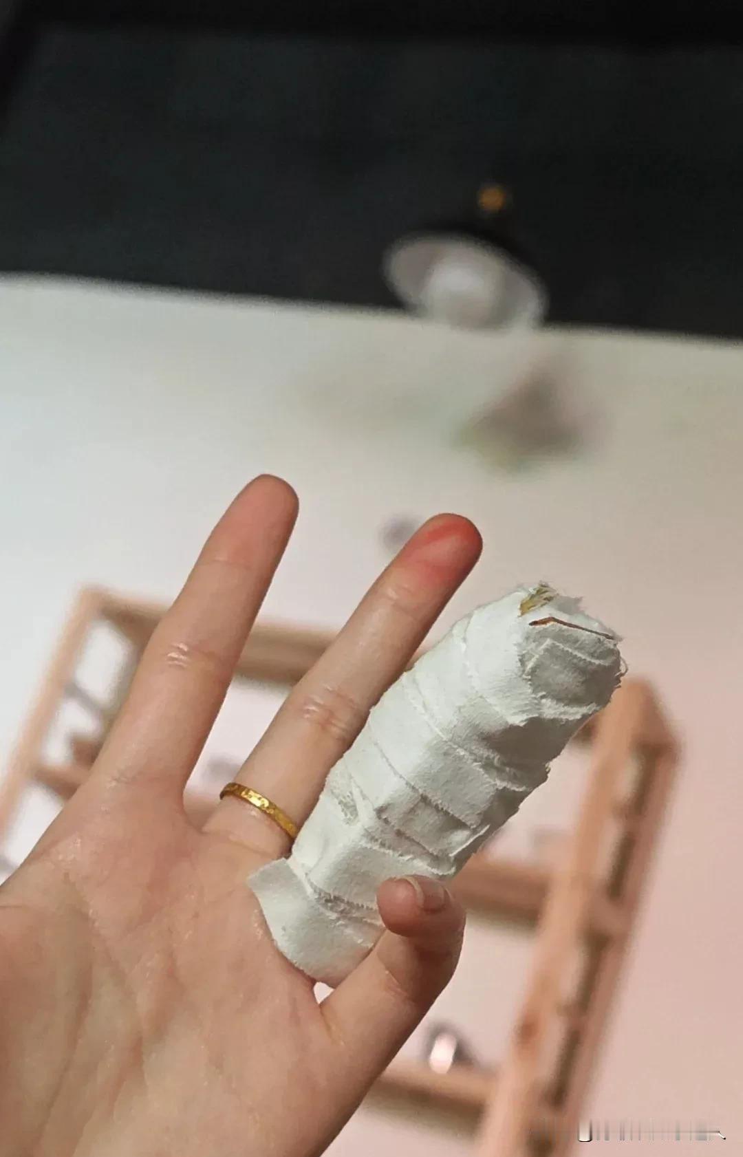 被小米SU7电吸门夹到骨折！提醒大家注意关门安全！
 
谁懂啊！被自己的小米SU