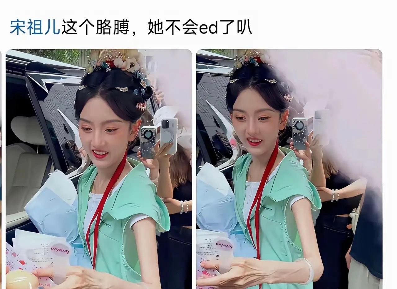 宋祖儿镯子都滑到大臂了 她真不饿吗 