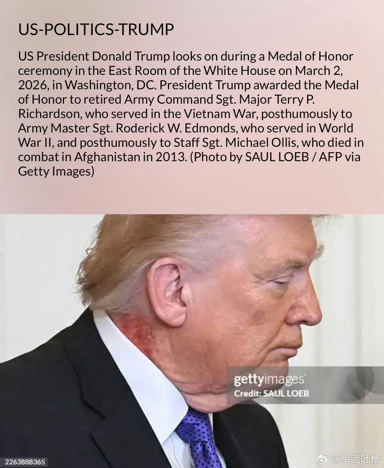 川普这是在爱泼斯坦岛染上毒了？脖子都烂了 