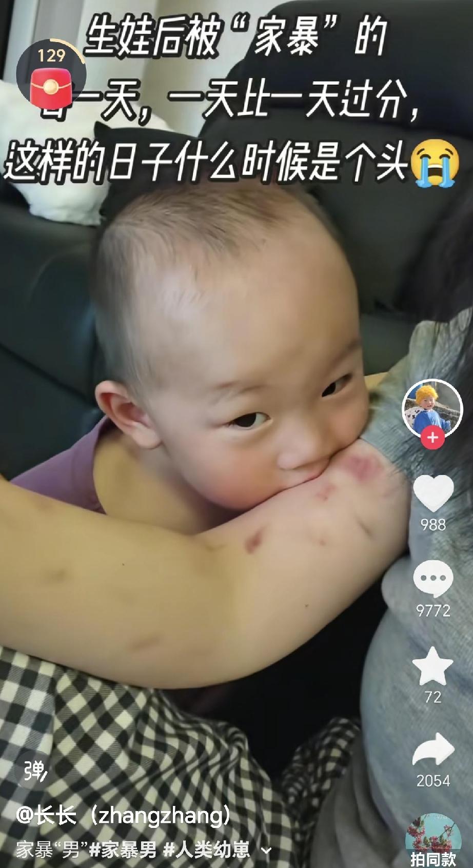 这是为了流量摆拍的，还是真有这样当妈的，这个妈妈伸出她满手的伤，戏谑的说我被我儿