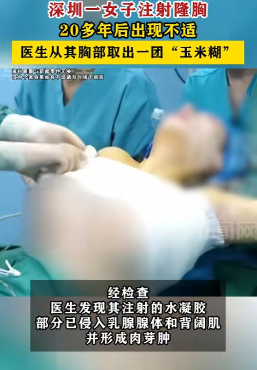 太吓人了，6月25号，深圳一个王女士，因为胸部持续不舒服去医院。结果一查，当年打